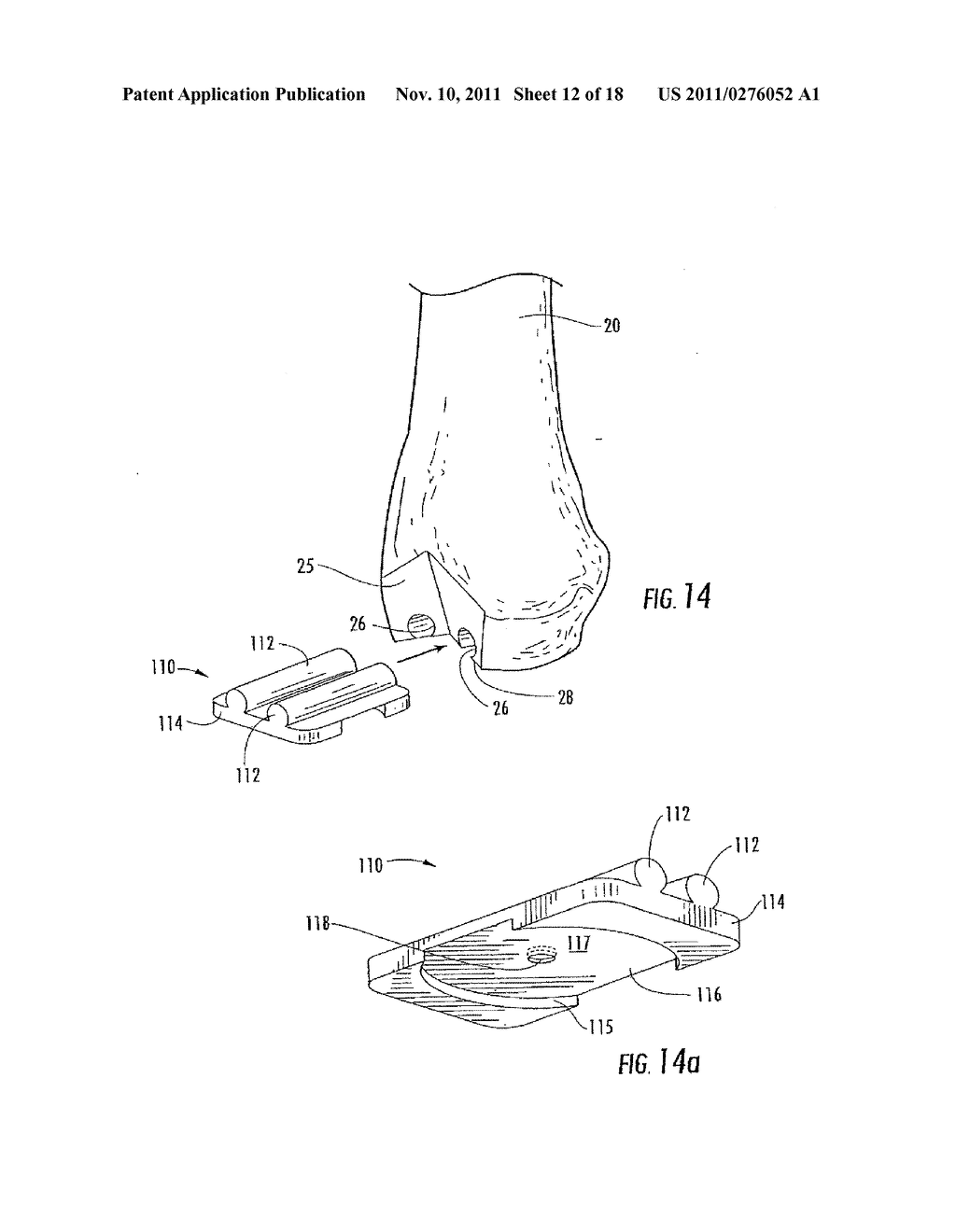 Method of Preparing an Ankle Joint for Replacement, Joint Prosthesis, and     Cutting Alignment Apparatus for Use in Performing an Arthroplasty     Procedure - diagram, schematic, and image 13