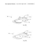 Method of Preparing an Ankle Joint for Replacement, Joint Prosthesis, and     Cutting Alignment Apparatus for Use in Performing an Arthroplasty     Procedure diagram and image