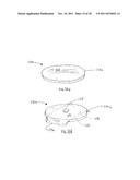 Method of Preparing an Ankle Joint for Replacement, Joint Prosthesis, and     Cutting Alignment Apparatus for Use in Performing an Arthroplasty     Procedure diagram and image