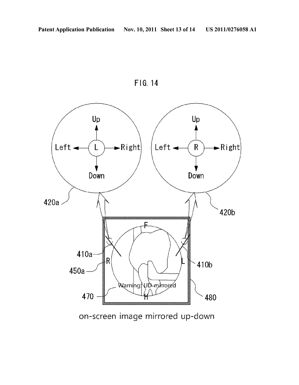 SURGICAL ROBOT SYSTEM, AND METHOD FOR CONTROLLING SAME - diagram, schematic, and image 14