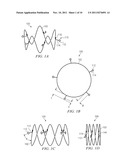 Anchors with Biodegradable Constraints diagram and image