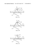 Anchors with Biodegradable Constraints diagram and image