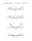 Anchors with Biodegradable Constraints diagram and image