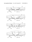 Anchors with Biodegradable Constraints diagram and image