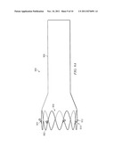 Anchors with Biodegradable Constraints diagram and image