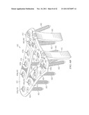 System for Treating Bone Fractures diagram and image