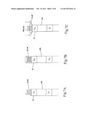 REDUNDANT PACING SYSTEM WITH LEADED AND LEADLESS PACING diagram and image