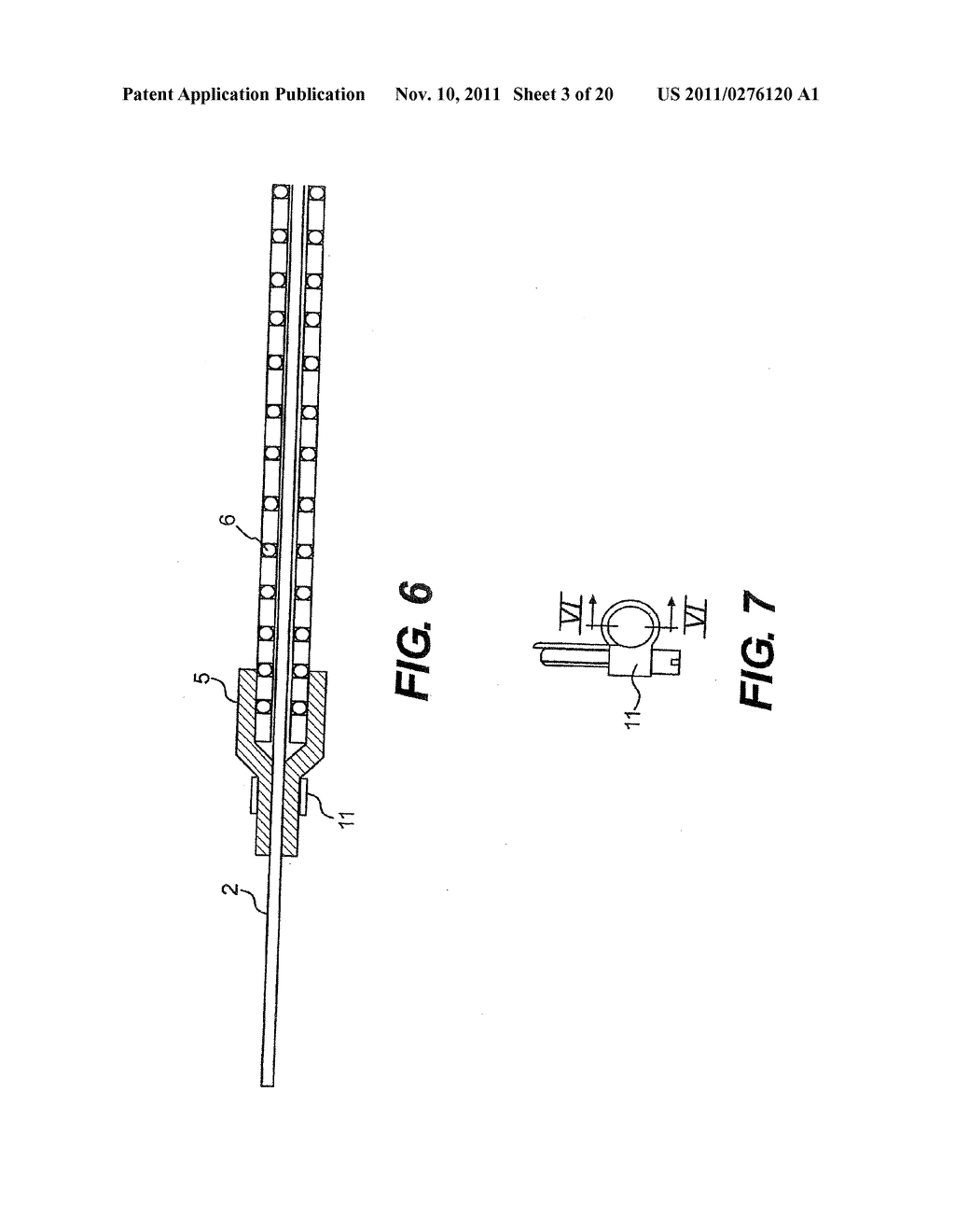 Vascular Device For Use During An Interventional Procedure - diagram, schematic, and image 04