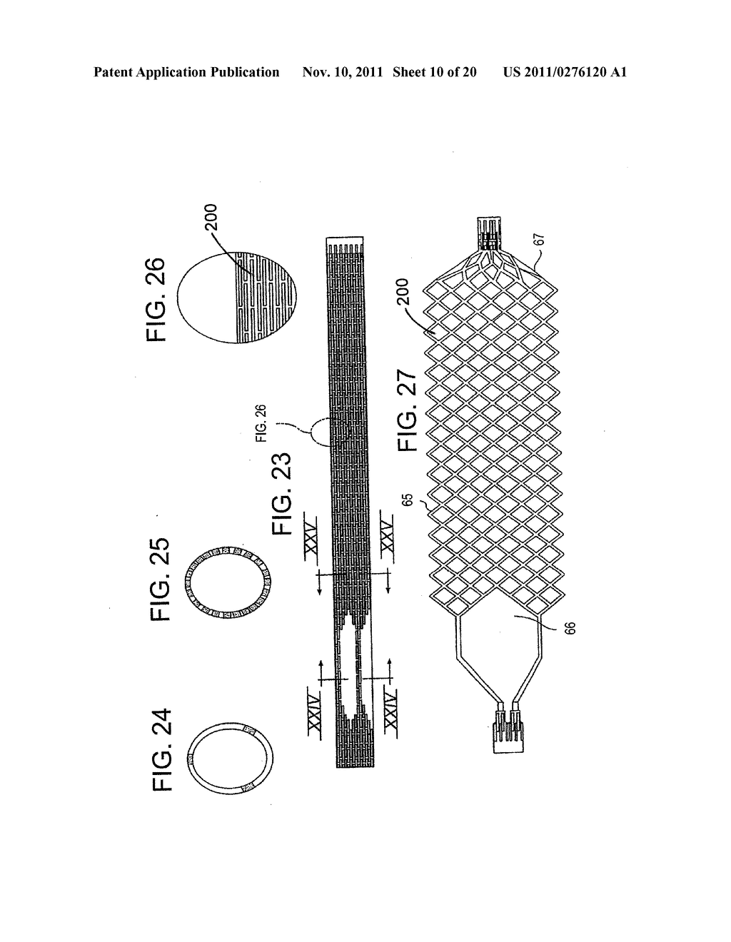 Vascular Device For Use During An Interventional Procedure - diagram, schematic, and image 11
