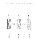 BIOCORRODABLE IMPLANT IN WHICH CORROSION MAY BE TRIGGERED OR ACCELERATED     AFTER IMPLANTATION BY MEANS OF AN EXTERNAL STIMULUS diagram and image