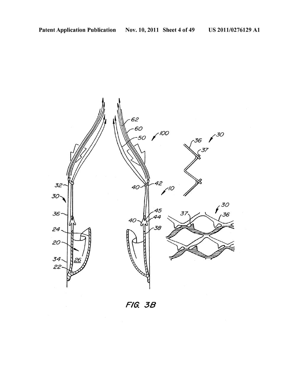 REPLACEMENT VALVE AND ANCHOR - diagram, schematic, and image 05