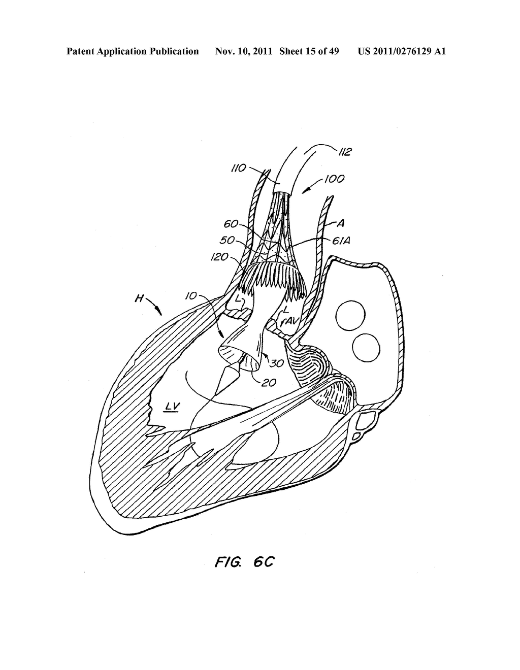 REPLACEMENT VALVE AND ANCHOR - diagram, schematic, and image 16