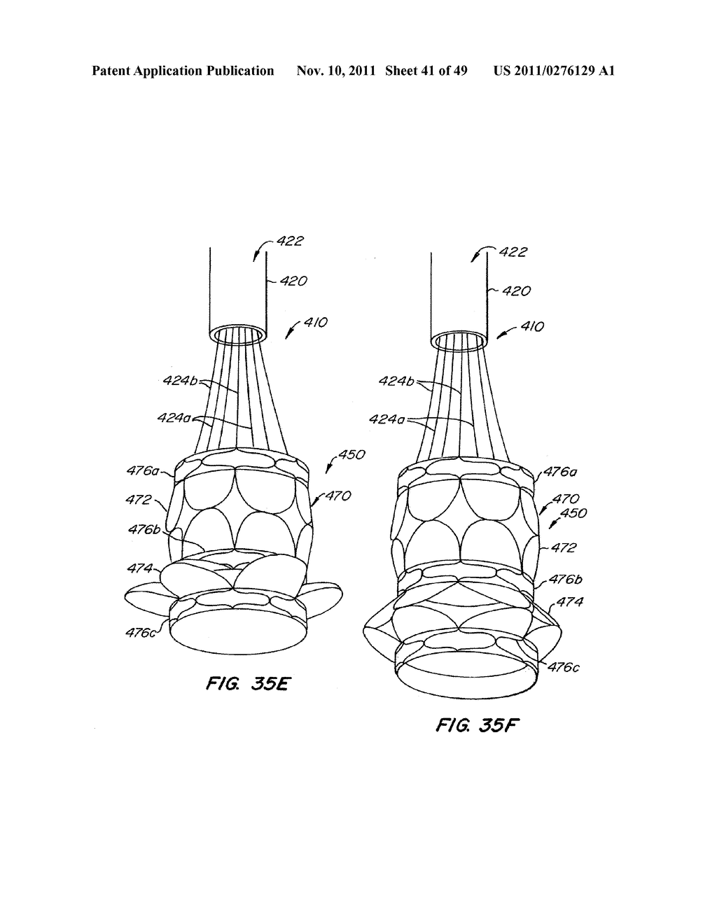 REPLACEMENT VALVE AND ANCHOR - diagram, schematic, and image 42