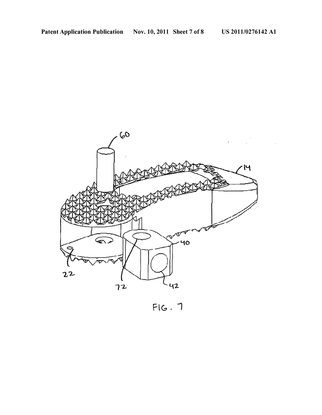 Articulating Spacer - diagram, schematic, and image 08