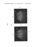 ULTRASOUND SYSTEM AND SIGNAL PROCESSING UNIT CONFIGURED FOR TIME GAIN AND     LATERAL GAIN COMPENSATION diagram and image