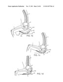 METHOD AND APPARATUS FOR DYNAMICALLY CORRECTING POSTURE diagram and image