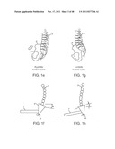 METHOD AND APPARATUS FOR DYNAMICALLY CORRECTING POSTURE diagram and image