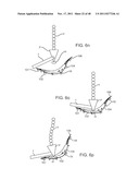 METHOD AND APPARATUS FOR DYNAMICALLY CORRECTING POSTURE diagram and image