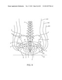 METHOD AND APPARATUS FOR DYNAMICALLY CORRECTING POSTURE diagram and image