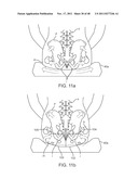 METHOD AND APPARATUS FOR DYNAMICALLY CORRECTING POSTURE diagram and image