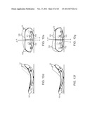 METHOD AND APPARATUS FOR DYNAMICALLY CORRECTING POSTURE diagram and image