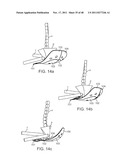 METHOD AND APPARATUS FOR DYNAMICALLY CORRECTING POSTURE diagram and image