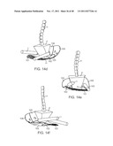 METHOD AND APPARATUS FOR DYNAMICALLY CORRECTING POSTURE diagram and image