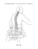 METHOD AND APPARATUS FOR DYNAMICALLY CORRECTING POSTURE diagram and image