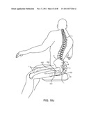 METHOD AND APPARATUS FOR DYNAMICALLY CORRECTING POSTURE diagram and image