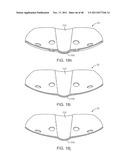 METHOD AND APPARATUS FOR DYNAMICALLY CORRECTING POSTURE diagram and image