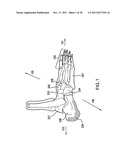 CUSHIONED ORTHOTIC diagram and image