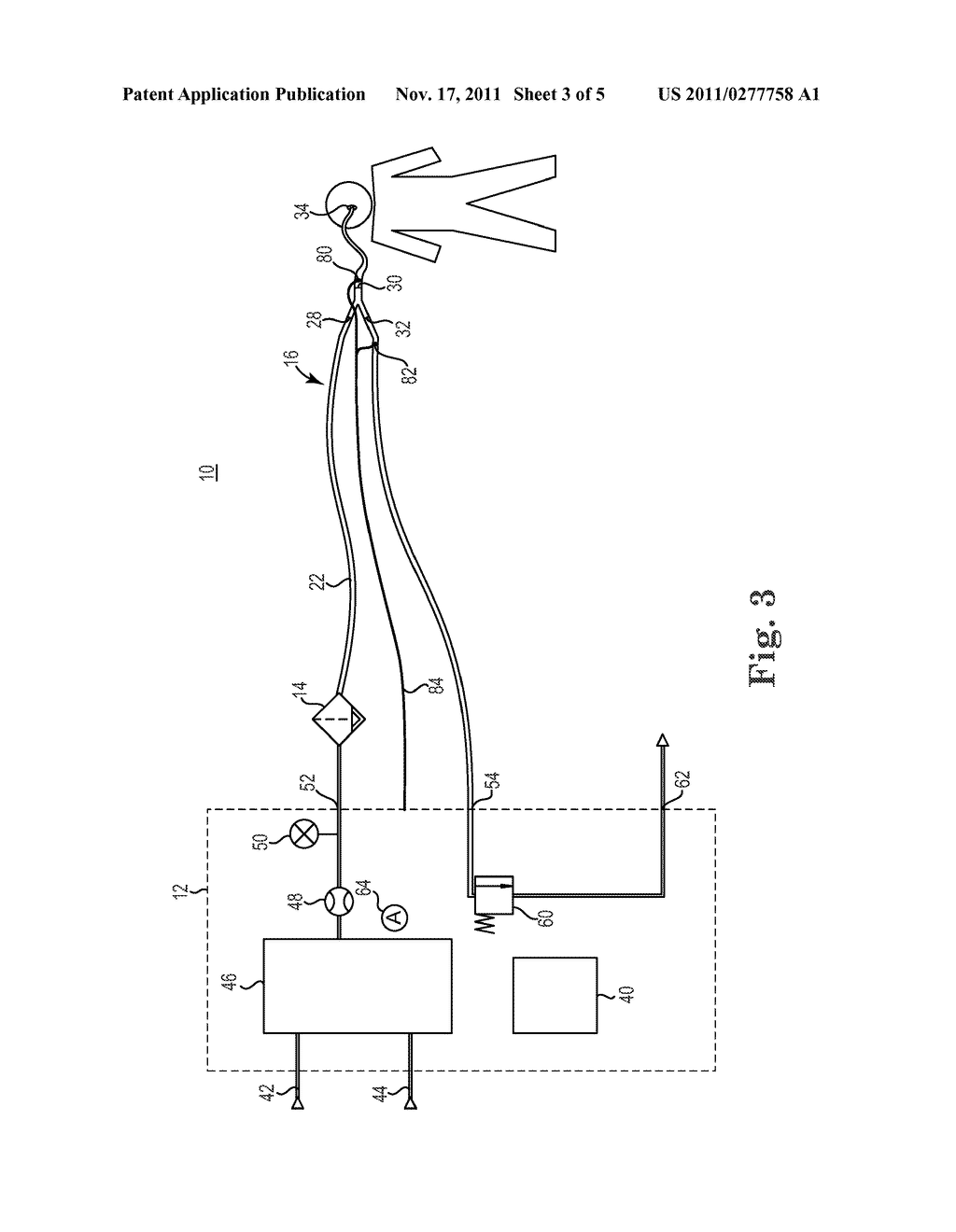 PATIENT CIRCUIT INTEGRITY ALARM USING EXHALED CO2 - diagram, schematic, and image 04