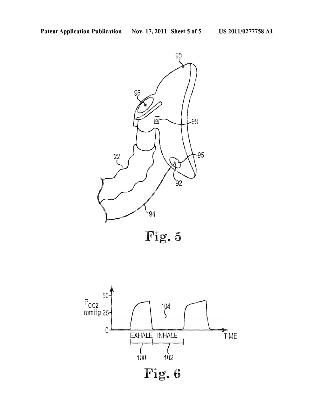 PATIENT CIRCUIT INTEGRITY ALARM USING EXHALED CO2 - diagram, schematic, and image 06