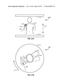 SYNCHRONIZED X-RAY / BREATHING METHOD AND APPARATUS USED IN CONJUNCTION     WITH A CHARGED PARTICLE CANCER THERAPY SYSTEM diagram and image