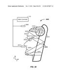 SYNCHRONIZED X-RAY / BREATHING METHOD AND APPARATUS USED IN CONJUNCTION     WITH A CHARGED PARTICLE CANCER THERAPY SYSTEM diagram and image