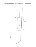 SKI WITH A CLIMBING SYSTEM, PARTICULARLY A CROSS-COUNTRY (XC) SKI diagram and image