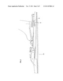 SKI WITH A CLIMBING SYSTEM, PARTICULARLY A CROSS-COUNTRY (XC) SKI diagram and image