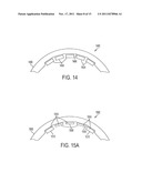 Motor With Overmolded Permanent Magnets diagram and image