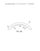 Motor With Overmolded Permanent Magnets diagram and image