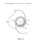 OPTICAL COHERENCE TOMOGRAPHY WITH MULTIPLE SAMPLE ARMS diagram and image