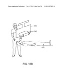 OPTICAL COHERENCE TOMOGRAPHY WITH MULTIPLE SAMPLE ARMS diagram and image