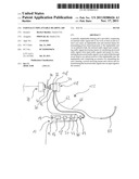 Partially Implantable Hearing Aid diagram and image