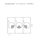 Breast Segmentation in Radiographic Images diagram and image