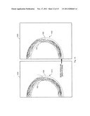 Breast Segmentation in Radiographic Images diagram and image