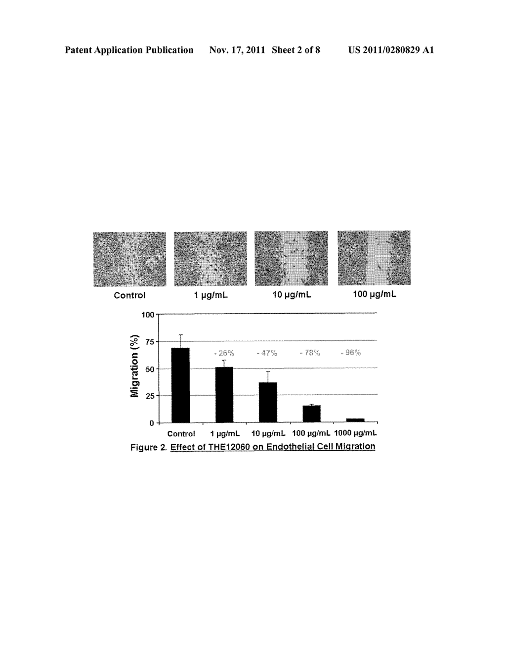 Low Molecular Weight Sulphated Polysaccharides as Candidates for     Anti-Angiogenic Therapy - diagram, schematic, and image 03