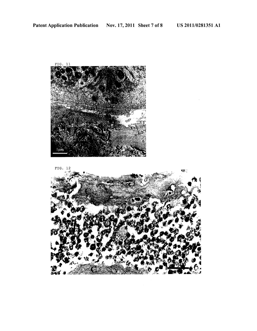 PROCESS FOR PRODUCING LAMINATED HIGH-DENSITY CULTURED ARTIFICIAL TISSUE,     AND LAMINATED HIGH-DENSITY CULTURED ARTIFICIAL TISSUE - diagram, schematic, and image 08