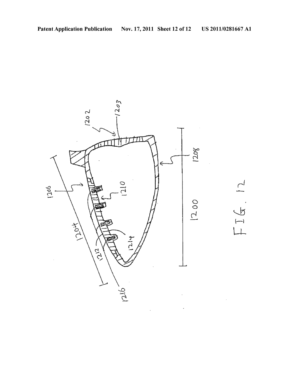 GOLF CLUB HEAD WITH STIFFENING AND SOUND TUNING COMPOSITE MEMBER - diagram, schematic, and image 13