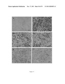 Pharmaceutical compositions containing berberine for treatment or     prevention of weight gain and obesity associated with anti-psychotic     drugs diagram and image