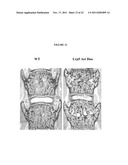 METHODS OF PREVENTING AND TREATING LOW BONE MASS DISEASES diagram and image