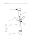 CATHETER PUMP FOR CIRCULATORY SUPPORT diagram and image